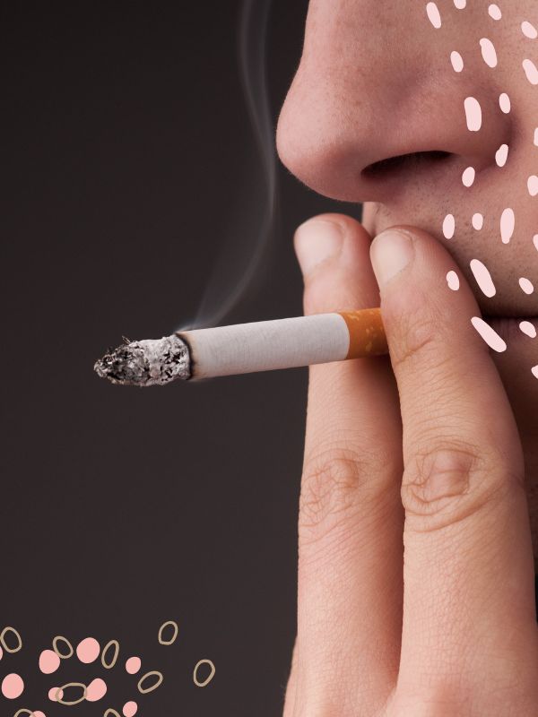 Smoking Cessation Hypnotherapy